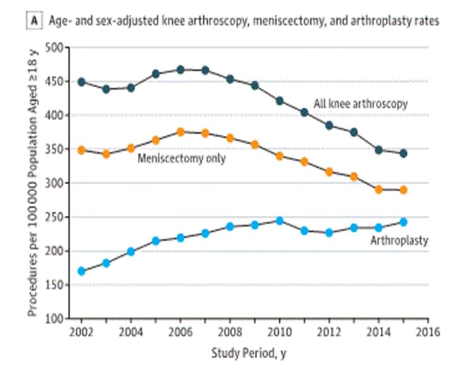 Knee Arthroscopic Surgeries on the Decline RheumNow